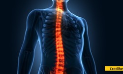 Spine Surgery: Solution to spinal problems