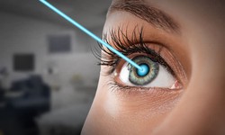The Journey to Clarity: What to Expect Before and After Your LASIK Procedure