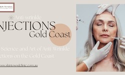 The Science and Art of Anti-Wrinkle Injections on the Gold Coast