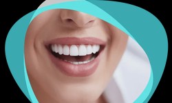 Unveiling the Truth: Debunking 10 Myths About Porcelain Veneers