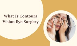 What Is Contoura Vision Eye Surgery?