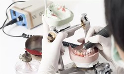 Finding the Perfect Dental Laboratory NYC