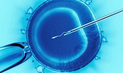 ICSI can be used to overcome fertilization issues