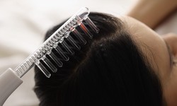 Why does one need to visit the best hair loss dermatologist?