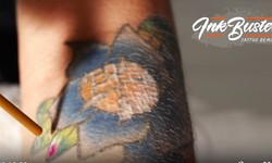 Ink Busters: Your Premier Choice for Laser Tattoo Removal in Las Vegas, Southern Nevada