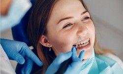 Whiter, Brighter, Beautiful: The Power of Teeth Whitening in Turkey