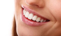 Brighten Your Smile with Expert Teeth Whitening at DenCare Clinic