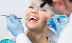 Guide Of Dental Implants And Affordable Options
