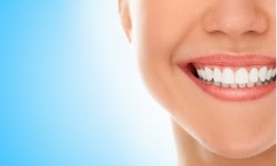 From Stains to Shine: Exploring the Top Teeth Whitening Services in Glenview