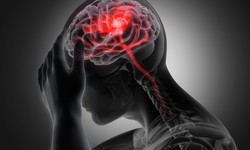 An Insight to Traumatic Brain Injuries: A Complete Guide to TBI Diagnosis!