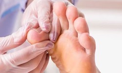 Ankle Specialist Wollongong: Navigating Your Path to Healthy Ankles