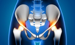 Benefits of Robotic Hip Replacement