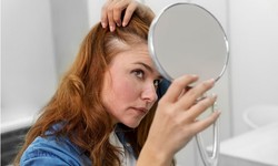 Feminine Follicles: The Journey of Hair Transplants for Women Unveiled