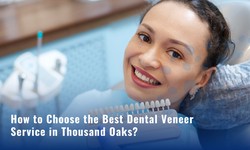 How to Choose the Best Dental Veneer Service in Thousand Oaks?