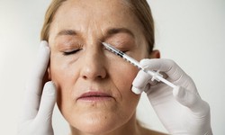 Timeless Radiance: A Guide to Anti-Wrinkle Injections in London