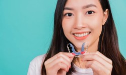 Retainers And Beyond: Maintaining Your Smile After Orthodontic Services