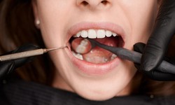 Grins in Westport: Your Comprehensive Guide to Dental Clinics