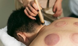 Explore the Benefits of Acupuncture for MS Relief