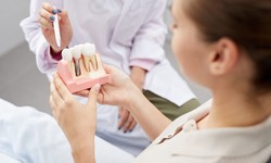 Winter with Sensitive Teeth: Tips from Dentists