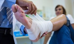 A Comprehensive Guide to Foot and Ankle Reconstruction Surgery