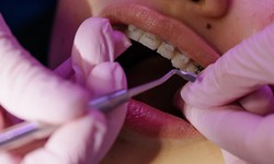 Dental Services in Bunbury: Your Comprehensive Guide to Optimal Dental Care