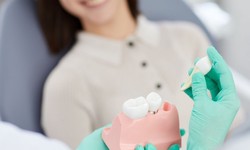 How to Choose the Right Dentist for Your Tooth Extraction?