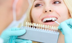 Elevate Your Smile with Dual Image Dentistry: Your Premier Charlotte Cosmetic Dentist