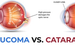 What are the differences between cataract treatment and glaucoma treatment?