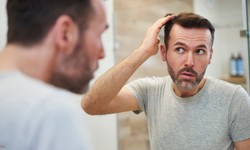 The Ultimate Guide to Hair Transplants in Ft. Lauderdale: SmartGraft Restoration