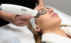 Laser Hair Removal Packages Toronto: Unveiling the Secrets to Silky Smooth Skin