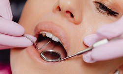 Why Choose Dallas Dental Implant Center for Your Dental Needs