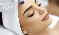 Microneedling A Comprehensive Guide to Before and After Care