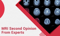 The Importance of CT and MRI Second Opinions