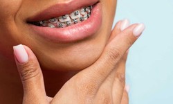 The Science of Smiles: Exploring Orthodontics