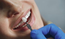 Top-Notch Dentistry: Your Guide to the Best Dentist in Glenview