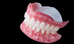 Best Dental Implants San Diego @ Mesadentalsd to Transform Your Smile