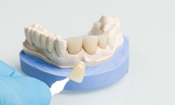 Veneers for Uneven Teeth: How They Can Create a Uniform Smile