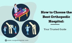 How to Choose the Best Orthopedic Hospital: Your Trusted Guide