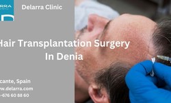 Conquer Hair Loss: Unraveling The Secrets To The Best Hair Transplant Surgery In Denia