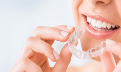 Your Path to the Best Invisalign Treatment