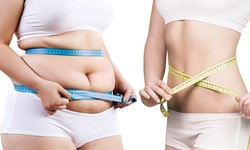 Why Consider Gastric Balloon for Safe and Effective Weight Loss?