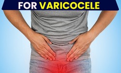 Testicular varicocele treatment without surgery