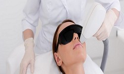 Exploring the Myths and Facts of Laser Hair Removal: Unveiling the Truth Behind the Beam
