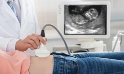 How to Choose a Gynecologist for Pregnancy