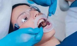 Root Canal Recovery: Tips for a Smooth Healing Process