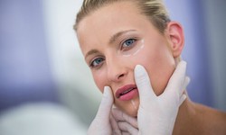 Tear Trough Fillers in the UK: Banishing Under-Eye Hollows for Good