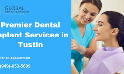 Premier Dental Implant Services in Tustin