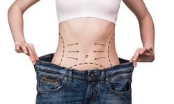 Why You Should Consult a Gastric Sleeve Surgeon for Weight Loss