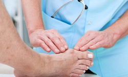 10 Steps to get rid of Bunion Pain