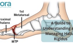 A Guide to Understanding and Managing Hallux Rigidus